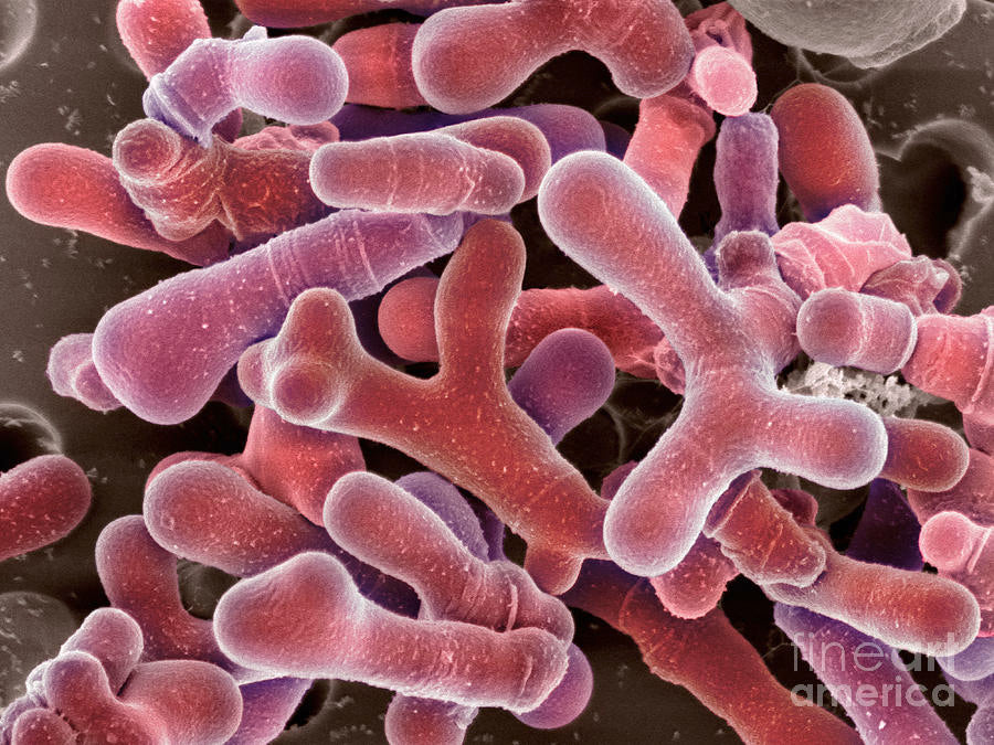 files/Bifidobacterium_animalis.jpg